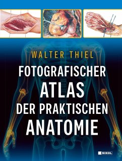 Fotografischer Atlas der Praktischen Anatomie - Thiel, Walter