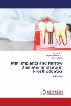 Mini Implants and Narrow Diameter Implants in Prosthodontics - S., Anumitha;S. I., Joephin Soundar;Rose, Shyma