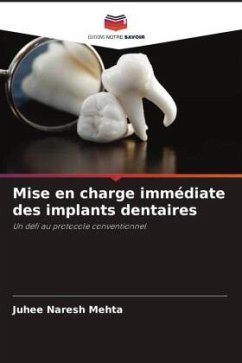 Mise en charge immédiate des implants dentaires - Mehta, Juhee Naresh