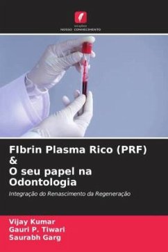 FIbrin Plasma Rico (PRF) & O seu papel na Odontologia - Kumar, Vijay;Tiwari, Gauri P.;Garg, Saurabh