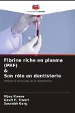 FIbrine riche en plasma (PRF) & Son rôle en dentisterie