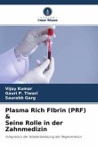 Plasma Rich FIbrin (PRF) & Seine Rolle in der Zahnmedizin
