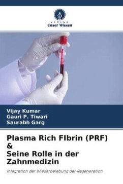 Plasma Rich FIbrin (PRF) & Seine Rolle in der Zahnmedizin - Kumar, Vijay;Tiwari, Gauri P.;Garg, Saurabh