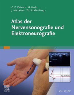 Atlas der Nervensonografie und Elektroneurografie (eBook, ePUB)