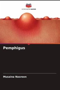 Pemphigus - Nasreen, Musaina