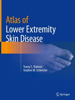 Atlas of Lower Extremity Skin Disease - Vlahovic, Tracey C.;Schleicher, Stephen M.