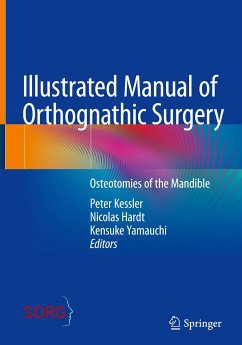 Illustrated Manual of Orthognathic Surgery