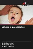 Labbro e palatoschisi