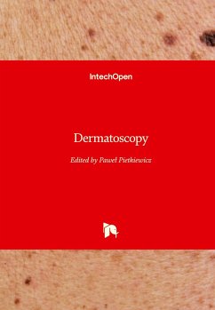 Dermatoscopy