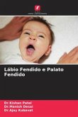 Lábio Fendido e Palato Fendido