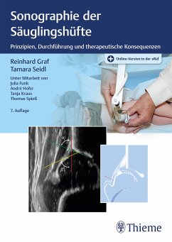 Sonographie der Säuglingshüfte (eBook, PDF) - Graf, Reinhard; Seidl, Tamara
