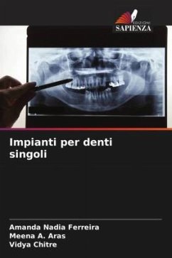 Impianti per denti singoli - Ferreira, Amanda Nadia;A. Aras, Meena;Chitre, Vidya