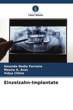 Einzelzahn-Implantate - Ferreira, Amanda Nadia;A. Aras, Meena;Chitre, Vidya