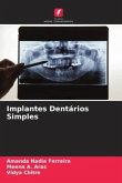 Implantes Dentários Simples
