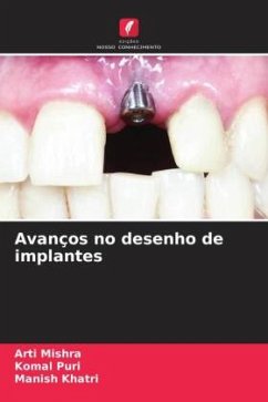 Avanços no desenho de implantes - Mishra, Arti;Puri, Komal;Khatri, Manish