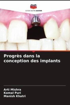 Progrès dans la conception des implants - Mishra, Arti;Puri, Komal;Khatri, Manish