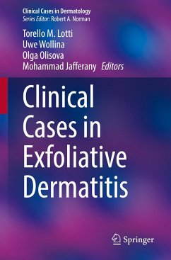 Clinical Cases in Exfoliative Dermatitis