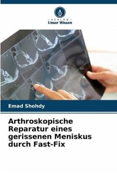 Arthroskopische Reparatur eines gerissenen Meniskus durch Fast-Fix - Shohdy, Emad