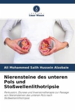 Nierensteine des unteren Pols und Stoßwellenlithotripsie - Salih Hussein Alzobaie, Ali Mohammed;Alhamdani, Nibbras Ibrahim