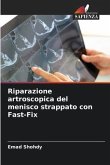 Riparazione artroscopica del menisco strappato con Fast-Fix