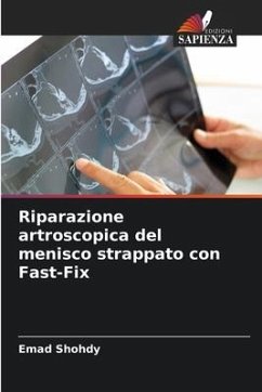 Riparazione artroscopica del menisco strappato con Fast-Fix - Shohdy, Emad