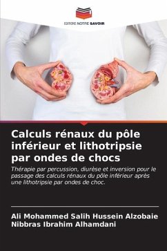 Calculs rénaux du pôle inférieur et lithotripsie par ondes de chocs - Salih Hussein Alzobaie, Ali Mohammed;Alhamdani, Nibbras Ibrahim