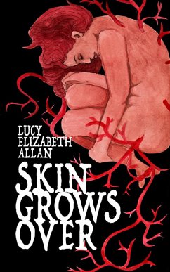 Skin Grows Over (eBook, ePUB) - Allan, Lucy Elizabeth