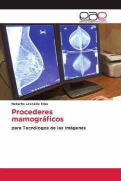Procederes mamográficos