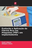 Evolução e Aplicação da Fibrina Rica em Plaquetas (PRF) em Implantodontia