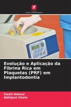 Evolução e Aplicação da Fibrina Rica em Plaquetas (PRF) em Implantodontia - Adasul, Swati;Shete, Abhijeet
