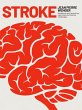 STROKE (eBook, PDF) - Bild 1