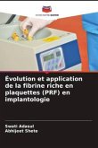 Évolution et application de la fibrine riche en plaquettes (PRF) en implantologie