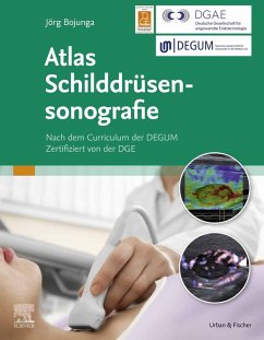 Atlas Schilddrüsensonografie (eBook, ePUB) - Bojunga, Jörg