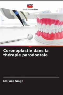 Coronoplastie dans la thérapie parodontale - Singh, Malvika