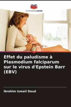 Effet du paludisme à Plasmodium falciparum sur le virus d'Epstein Barr (EBV) - Daud, Ibrahim Ismail