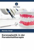 Koronoplastik in der Parodontaltherapie