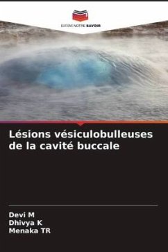 Lésions vésiculobulleuses de la cavité buccale - M, Devi;K, Dhivya;TR, Menaka