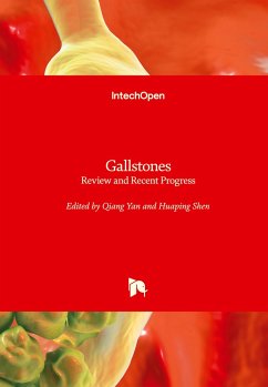 Gallstones