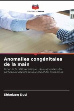 Anomalies congénitales de la main - Duci, Shkelzen