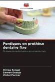 Pontiques en prothèse dentaire fixe