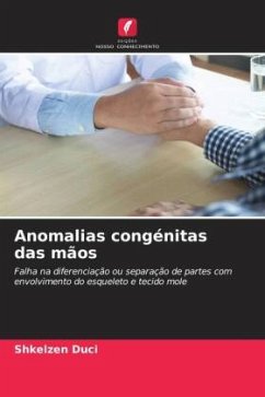 Anomalias congénitas das mãos - Duci, Shkelzen