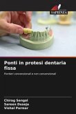 Ponti in protesi dentaria fissa