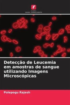 Detecção de Leucemia em amostras de sangue utilizando Imagens Microscópicas - Rajesh, Polepogu