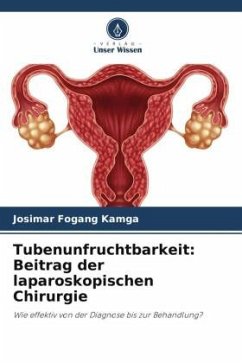 Tubenunfruchtbarkeit: Beitrag der laparoskopischen Chirurgie - Fogang Kamga, Josimar
