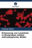Erkennung von Leukämie in Blutproben mittels mikroskopischer Bilder