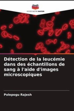 Détection de la leucémie dans des échantillons de sang à l'aide d'images microscopiques - Rajesh, Polepogu