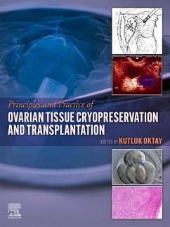 Cover Principles and Practice of Ovarian Tissue Cryopreservation and Transplantation (eBook, ePUB)