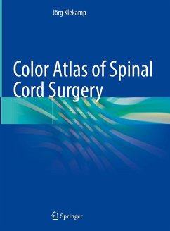 Color Atlas of Spinal Cord Surgery (eBook, PDF) - Klekamp, Jörg