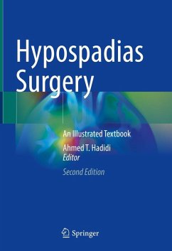 Hypospadias Surgery (eBook, PDF)