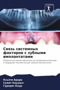 Swqz' sistemnyh faktorow s zubnymi implantatami - Arora, Kh'qti;Kaushal, Sumit;Kaur, Gurprit